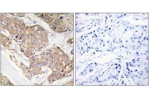 Immunohistochemistry (IHC) image for anti-Interleukin 13 Receptor, alpha 1 (IL13RA1) (AA 371-420) antibody (ABIN2888882)
