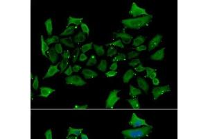 Immunofluorescence analysis of HeLa cells using ALAS1 Polyclonal Antibody (ALAS1 anticorps)