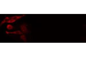 ABIN6277013 staining  HeLa cells by IF/ICC. (IFI16 anticorps  (C-Term))