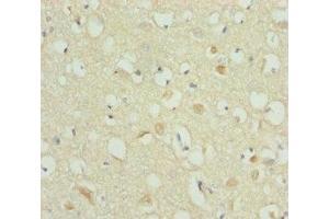 Immunohistochemistry of paraffin-embedded human brain tissue using ABIN7168273 at dilution of 1:100 (A2BP1 anticorps  (AA 1-130))