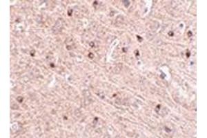 Immunohistochemistry of TOM70 in mouse brain tissue with this product at 2. (TOM70 anticorps  (Center))