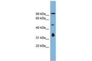 Image no. 1 for anti-MAK10 Homolog, Amino-Acid N-Acetyltransferase Subunit (MAK10) (AA 179-228) antibody (ABIN6743244) (MAK10/NAA35 anticorps  (AA 179-228))