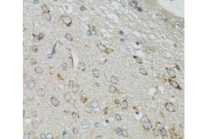 Immunohistochemistry of paraffin-embedded Mouse brain using DGUOK Polyclonal Antibody at dilution of 1:100 (40x lens). (Deoxyguanosine Kinase anticorps)