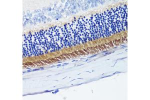 Immunohistochemistry of paraffin-embedded rat retina using PDE6B antibody (ABIN6132473, ABIN6145363, ABIN6145364 and ABIN6222688) at dilution of 1:200 (40x lens).