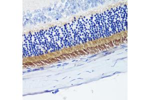 Immunohistochemistry of paraffin-embedded rat retina using PDE6B antibody (ABIN6132473, ABIN6145363, ABIN6145364 and ABIN6222688) at dilution of 1:200 (40x lens). (PDE6B anticorps  (AA 1-190))