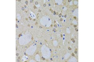 Immunohistochemistry of paraffin-embedded mouse brain using YWHAZ antibody.