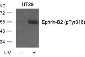 Western blot analysis of extracts from HT29 cells, untreated or treated with UV using Ephrin-B2 (Phospho-Tyr316). (Ephrin B2 anticorps  (pTyr316))