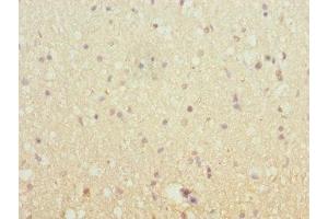 Immunohistochemistry of paraffin-embedded human brain tissue using ABIN7151640 at dilution of 1:100 (SH3G2 anticorps  (AA 1-270))