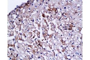 Formalin-fixed and paraffin embedded rabbit heart labeled with Anti CTn1/Troponin I/TNNC1 Polyclonal Antibody,Unconjugated  at 1:200 followed by conjugation to the secondary antibody and DAB staining.