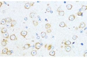 Immunohistochemistry of paraffin-embedded Mouse brain using Aromatase Polyclonal Antibody at dilution of 1:100 (40x lens). (Aromatase anticorps)