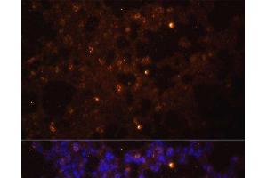 Immunofluorescence analysis of Mouse lung using IL1 beta Polyclonal Antibody at dilution of 1:100. (IL-1 beta anticorps)