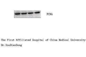 Western Blot (WB) analysis: Please contact us for more details. (PCNA anticorps)