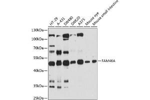 Western blot analysis of extracts of various cell lines, using FA antibody (ABIN6132080, ABIN6140461, ABIN6140462 and ABIN6216509) at 1:3000 dilution. (FAM46A anticorps  (AA 180-400))