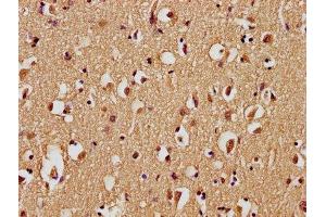 IHC image of ABIN7139743 diluted at 1:100 and staining in paraffin-embedded human brain tissue performed on a Leica BondTM system. (GPR77 anticorps  (AA 2-19))