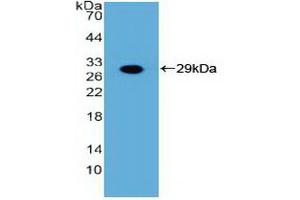 Detection of Recombinant FGFR3, Human using Polyclonal Antibody to Fibroblast Growth Factor Receptor 3 (FGFR3) (FGFR3 anticorps  (AA 166-375))