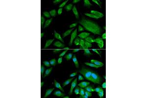 Immunofluorescence analysis of MCF-7 cells using CDK6 antibody. (CDK6 anticorps)