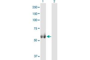 Western Blot analysis of ALDH4A1 expression in transfected 293T cell line by ALDH4A1 MaxPab polyclonal antibody. (ALDH4A1 anticorps  (AA 1-563))
