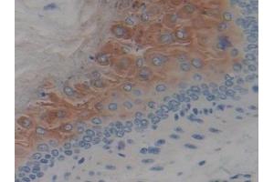 Detection of SPINK5 in Mouse Esophagus Tissue using Polyclonal Antibody to Serine Peptidase Inhibitor Kazal Type 5 (SPINK5)