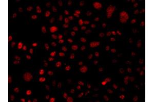 Immunofluorescence analysis of A549 cells using ARID1A antibody. (ARID1A anticorps)