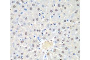 Immunohistochemistry of paraffin-embedded Rat liver using WDR48 Polyclonal Antibody at dilution of 1:100 (40x lens).