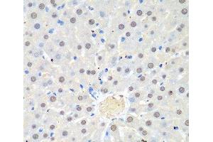Immunohistochemistry of paraffin-embedded Rat liver using WDR48 Polyclonal Antibody at dilution of 1:100 (40x lens). (WDR48 anticorps)