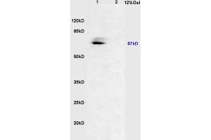 Lane 1: mouse embryo lysates Lane 2: rat brain lysates probed with Anti AVPR2 Polyclonal Antibody, Unconjugated (ABIN713231) at 1:200 in 4 °C.