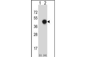 Western blot analysis of X (arrow) using rabbit polyclonal X Antibody (C-term) (ABIN657757 and ABIN2846739). (XPA anticorps  (C-Term))