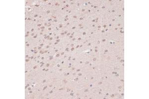 Immunohistochemistry of paraffin-embedded mouse brain using PRPF31 antibody (ABIN6132996, ABIN6146262, ABIN6146264 and ABIN6221399) at dilution of 1:100 (40x lens). (PRPF31 anticorps  (AA 1-200))