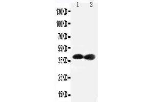 Anti-Cdk7 antibody,  Western blotting Lane 1: Rat Testis Tissue Lysate Lane 2: Rat Ovary Tissue Lysate (CDK7 anticorps  (C-Term))