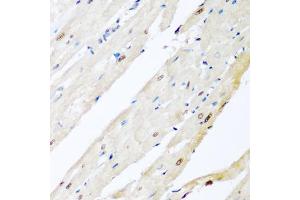 Immunohistochemistry of paraffin-embedded rat heart using VCP antibody (ABIN6290879) at dilution of 1:200 (40x lens). (VCP anticorps)