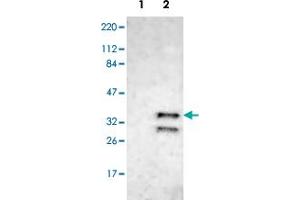 Western blot analysis of Lane 1: Human cell line RT-4; Lane 2: Human cell line U-251MG sp with CDK6 polyclonal antibody  at 1:100-1:250 dilution. (CDK6 anticorps)