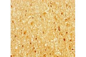 Immunohistochemistry of paraffin-embedded human brain tissue using ABIN7144657 at dilution of 1:100 (Aryl Hydrocarbon Receptor anticorps  (AA 126-353))