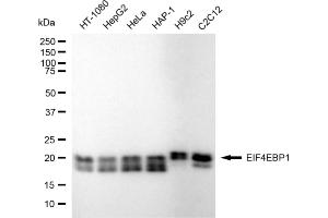Western blotting analysis using EIF4EBP1 antibody (ABIN7798532).