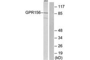 Western blot analysis of extracts from 293 cells, using GPR156 Antibody. (GPR156 anticorps  (AA 501-550))