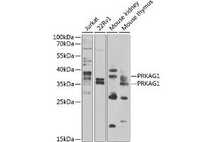 Western blot analysis of extracts of various cell lines, using PRK antibody (ABIN6132517, ABIN6146187, ABIN6146188 and ABIN6223135) at 1:1000 dilution. (PRKAG1 anticorps  (AA 1-331))