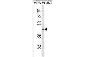 Western blot analysis in MDA-MB453 cell line lysates (35ug/lane). (ALG8 anticorps  (N-Term))