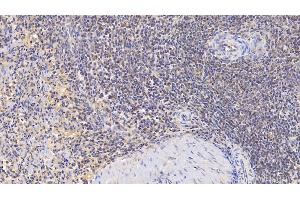 Detection of SELP in Human Spleen Tissue using Monoclonal Antibody to P-Selectin (SELP)