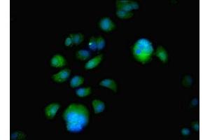 Immunofluorescent analysis of MCF-7 cells using ABIN7152042 at dilution of 1:100 and Alexa Fluor 488-congugated AffiniPure Goat Anti-Rabbit IgG(H+L)