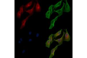 ABIN7094332 and ABIN7098379 staining  cells by IF/ICC. (LACTB anticorps  (Internal Region))