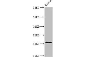 Western Blot Positive WB detected in: Rat brain tissue All lanes: RPL23A antibody at 3 μg/mL Secondary Goat polyclonal to rabbit IgG at 1/50000 dilution Predicted band size: 18 kDa Observed band size: 18 kDa (RPL23A anticorps  (AA 1-92))