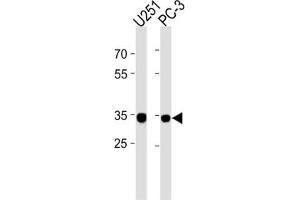 Western Blotting (WB) image for anti-Ribosomal Protein, Large, P0 Pseudogene 6 (RPLP0P6) antibody (ABIN3004613) (RPLP0P6 anticorps)