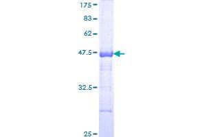 Image no. 1 for phosphoinositide Kinase, FYVE Finger Containing (PIKFYVE) (AA 342-451) protein (GST tag) (ABIN1315149)