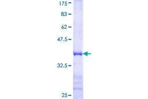 Image no. 1 for rho Guanine Nucleotide Exchange Factor (GEF) 12 (ARHGEF12) (AA 817-916) protein (GST tag) (ABIN1345539)