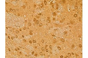 ABIN7094390 and ABIN7098437 at 1/100 staining Rat brain tissue by IHC-P. (NEO1 anticorps  (Internal Region))