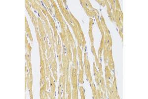Immunohistochemistry of paraffin-embedded mouse heart using CSRP3 Antibody (ABIN2562048) at dilution of 1:100 (40x lens). (CSRP3 anticorps)