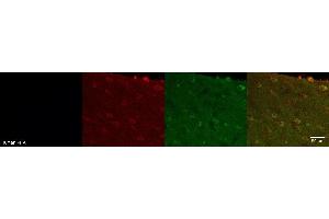 Immunohistochemistry (IHC) image for anti-Doublecortin Domain Containing 2 (DCDC2) antibody (ABIN7456335)