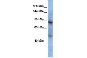 WB Suggested Anti-ZHX3 Antibody Titration: 0. (ZHX3 anticorps  (Middle Region))