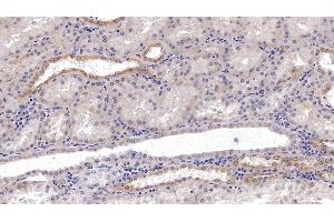 Detection of NCCT in Human Kidney Tissue using Monoclonal Antibody to Na-Cl Cotransporter (NCCT)