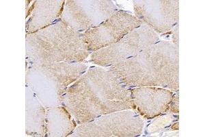Immunohistochemistry analysis of paraffin-embedded rat skeletal muscle using,PPAPDC3 (ABIN7075036) at dilution of 1: 4000 (PPAPDC3 anticorps)
