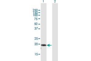 Western Blot analysis of AP3S2 expression in transfected 293T cell line by AP3S2 MaxPab polyclonal antibody.